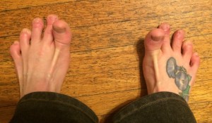 Toe Lifts